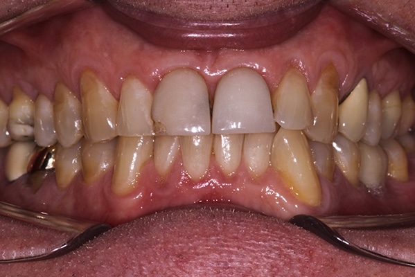 cosmetic-dentist-leicester-IMG_3457