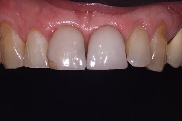 cosmetic-dentist-leicester-IMG_3462