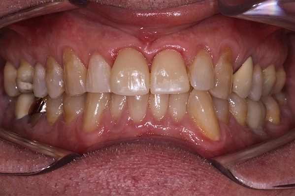 cosmetic-dentist-leicester-IMG_3715