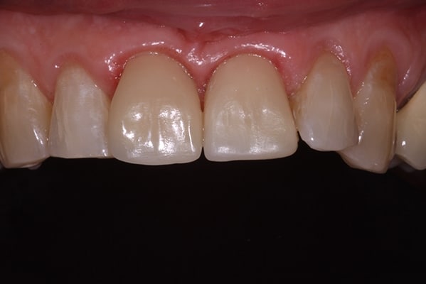 cosmetic-dentist-leicester-IMG_3718