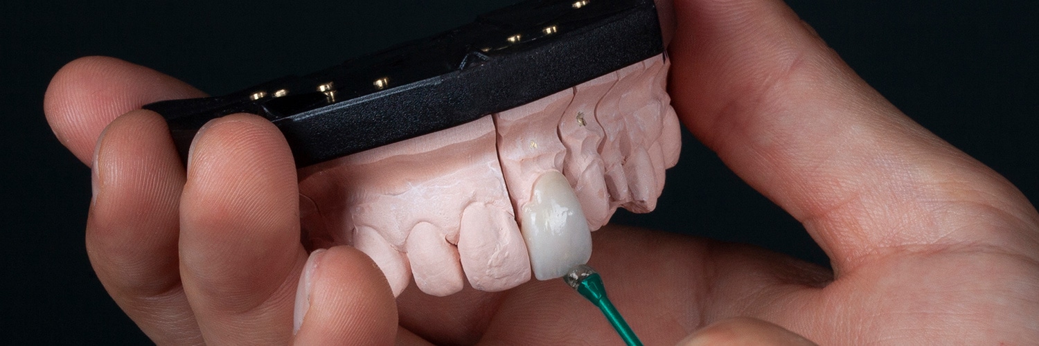 teeth-whitening-leciester-m