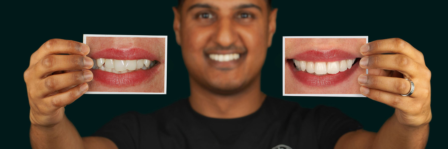 hero-banner-teeth-straightening-mobile