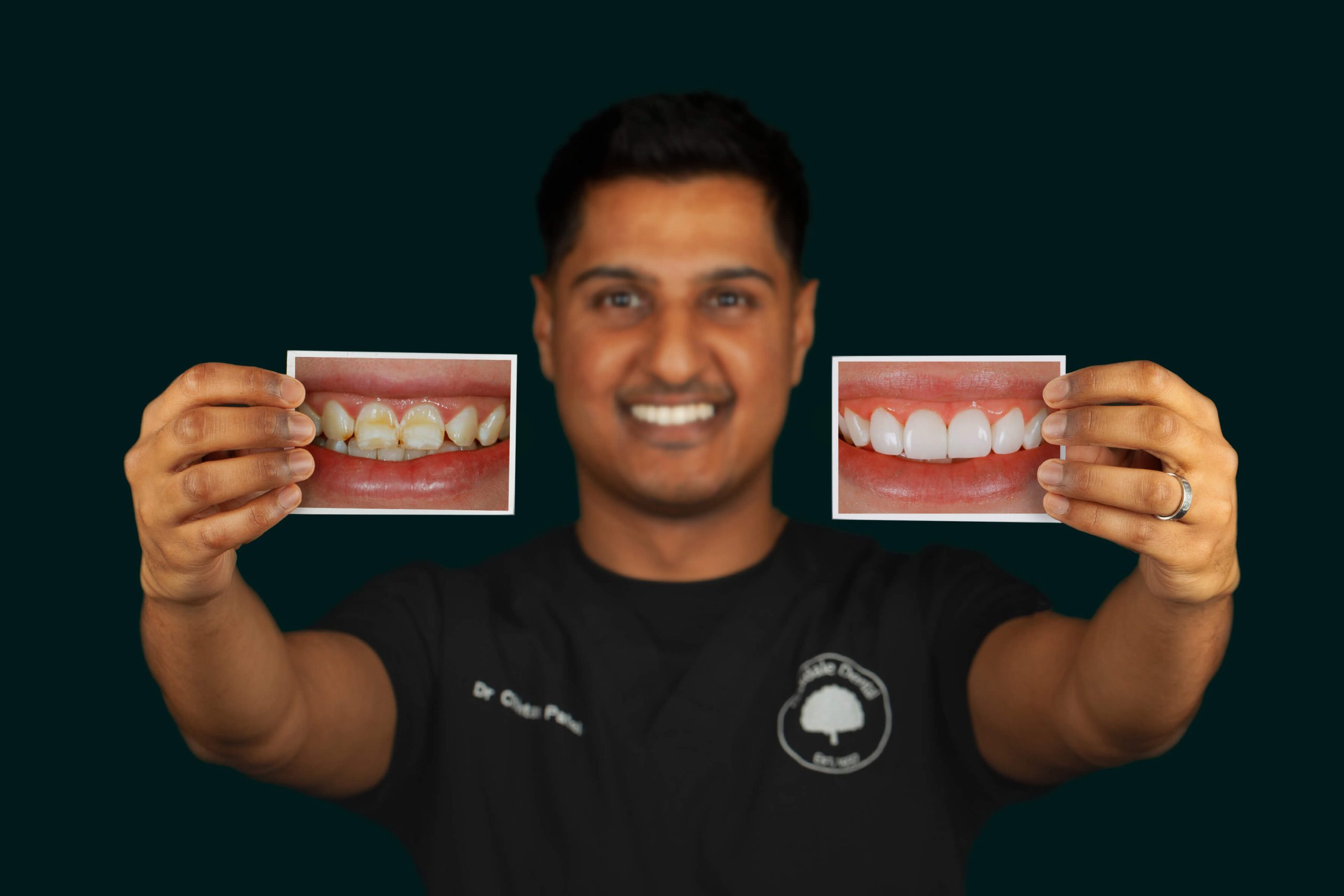 $variable({"type":"content","value":{"name":"post_title","settings":{"before":"","after":""}}})$