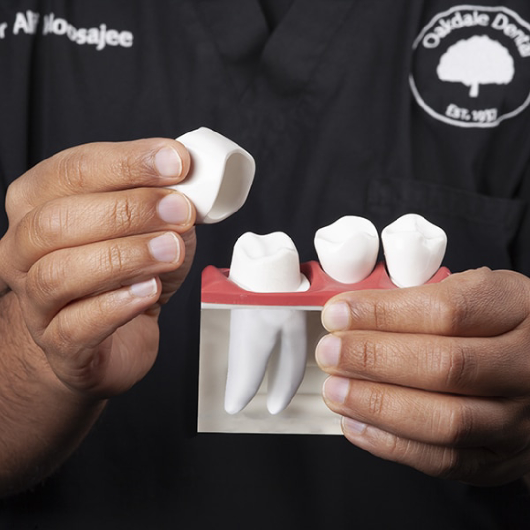 Dental Crown $variable({"type":"content","value":{"name":"post_title","settings":{"before":"","after":""}}})$