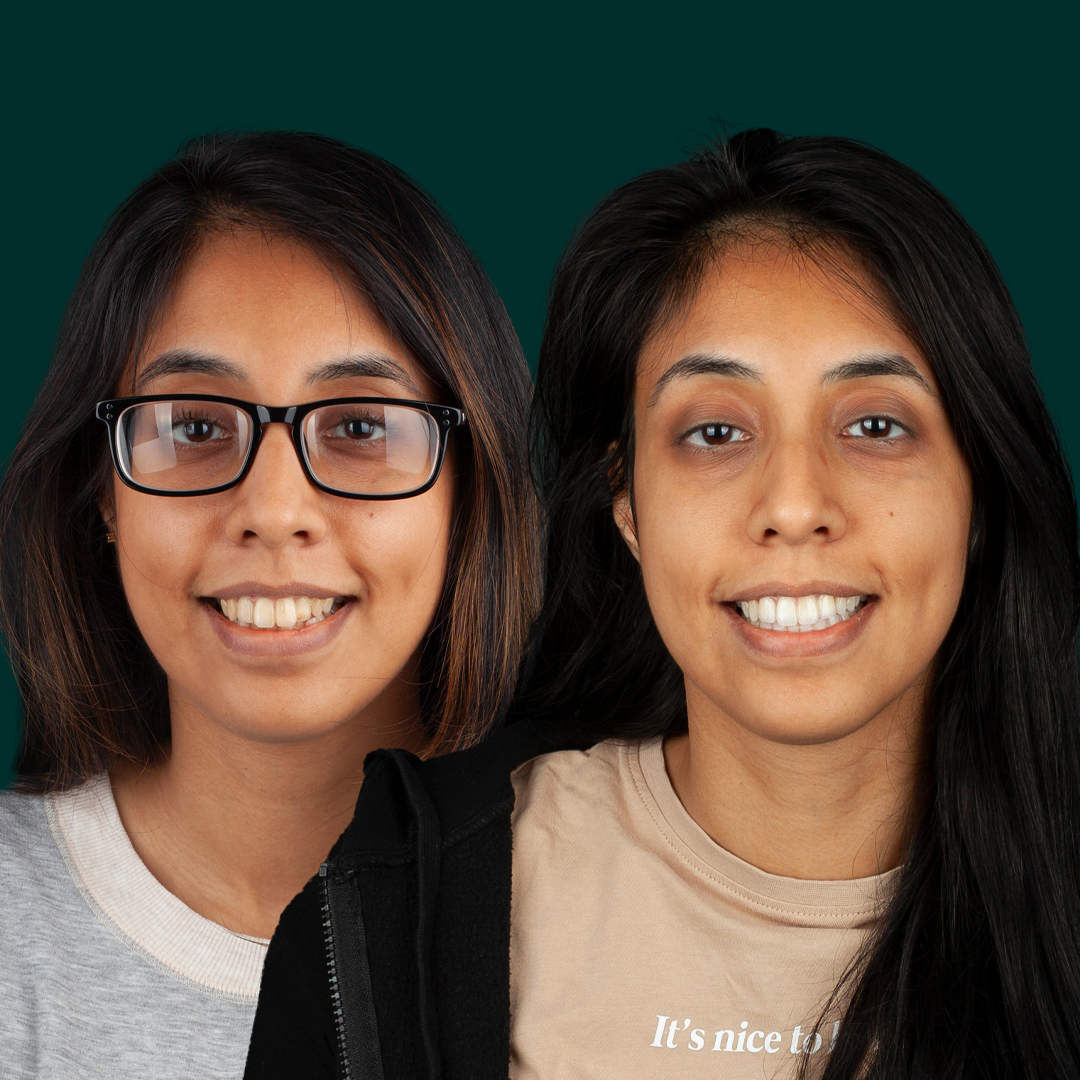 Before after straightening img 9