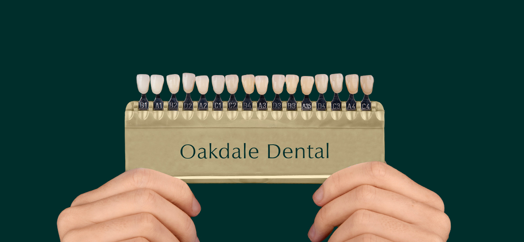 Teeth-Whitening-hero banner