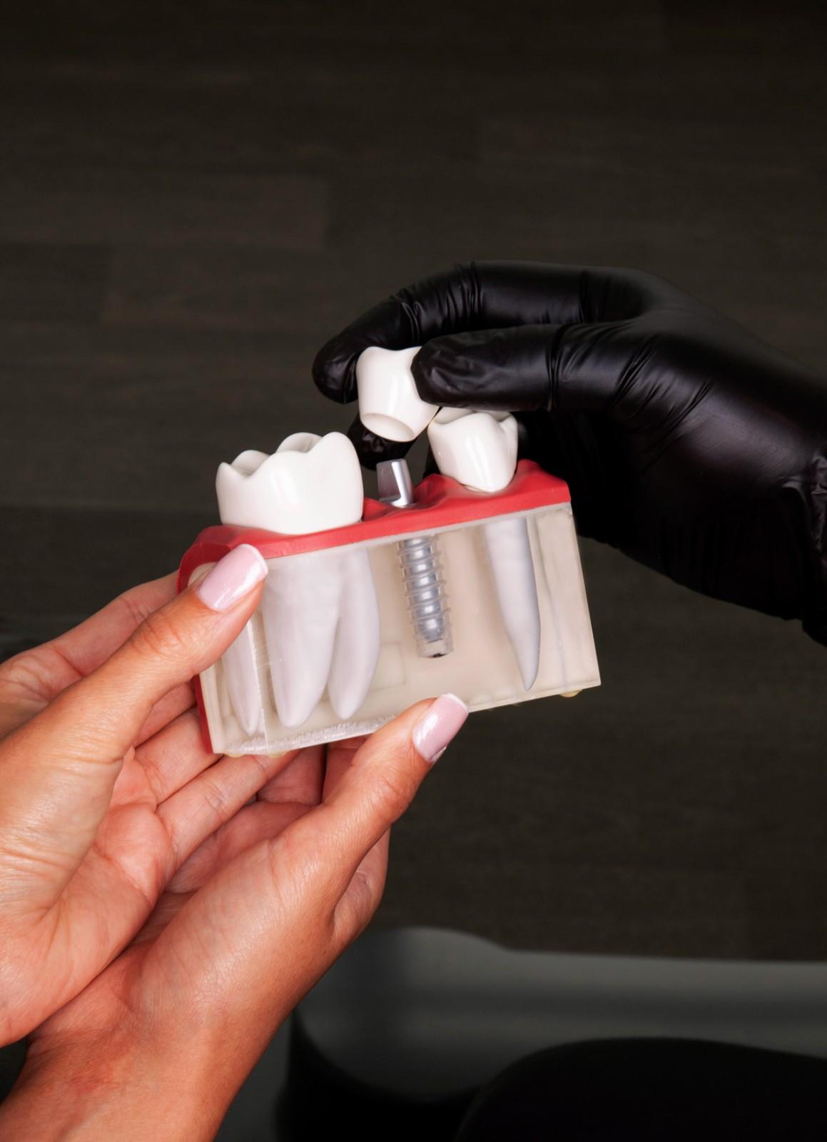 Dentalimplants_img3_2026